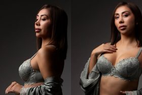 Naya Fácil sorprendió a sus seguidores tras compartir imágenes de su drástica operación: "Segura y feliz "
